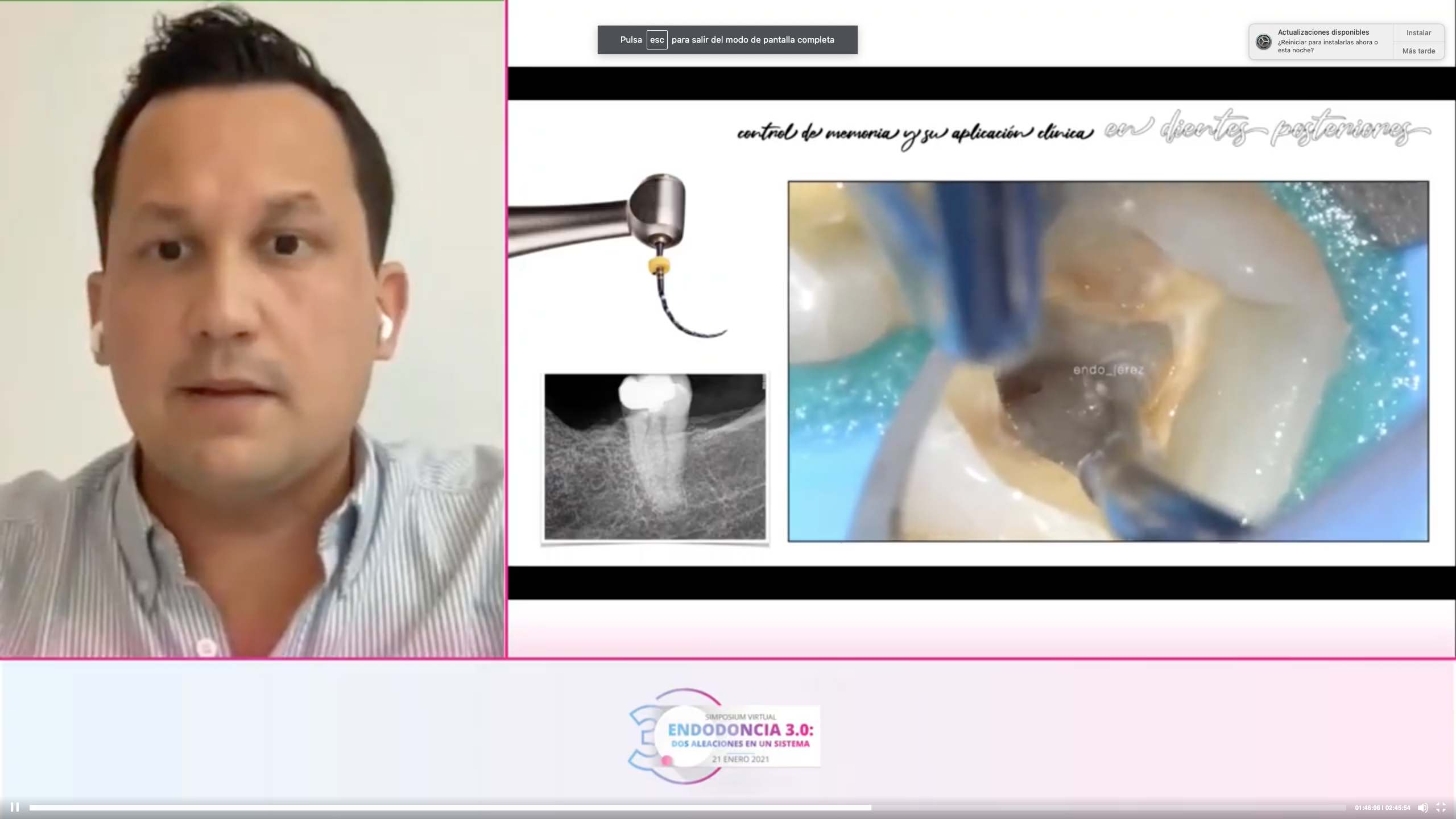 endodoncia3cero-ponente-carlos-ibanez
