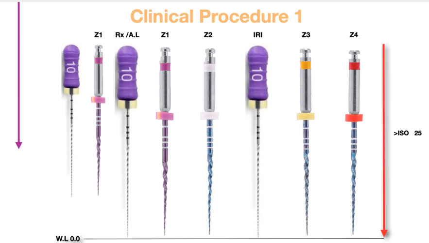 zarc-caso-clinico-secuencia-instrumentacion-limas-blueshaper